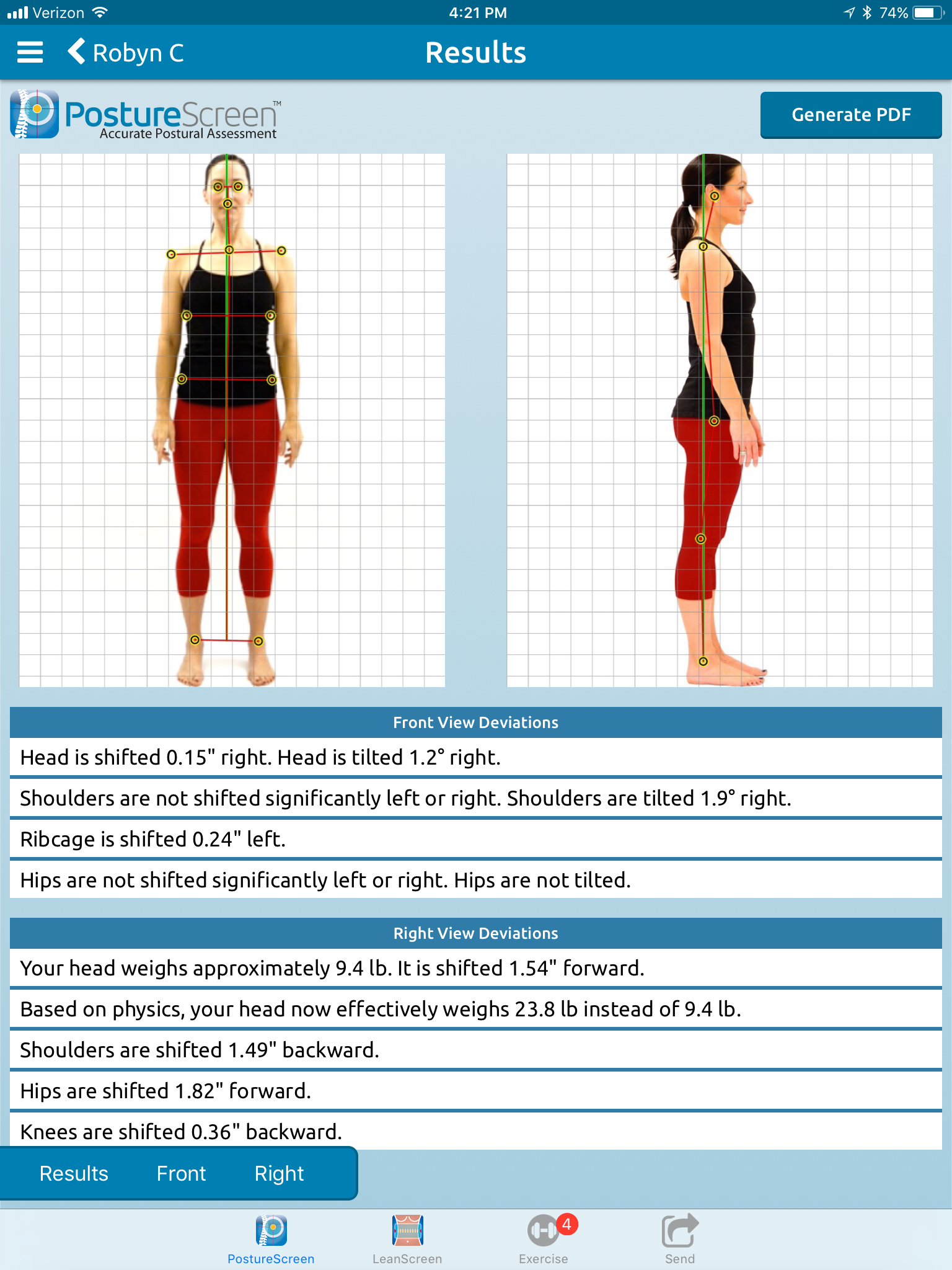 PostureScreen houdingsanalyse bij Atlas Chiropractie Houten
